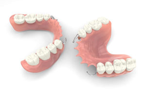partial dentures top and bottom