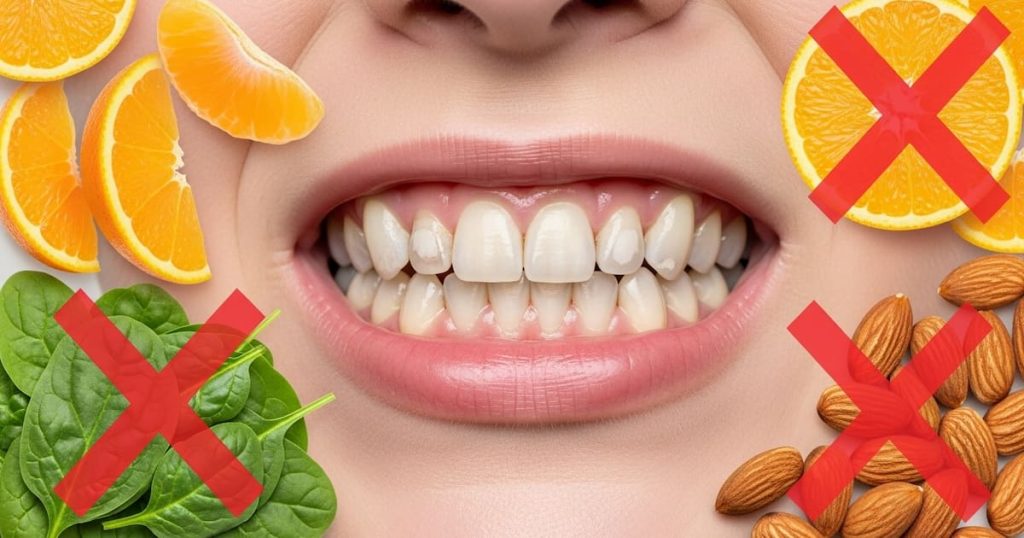 Close-up of teeth with early enamel erosion stains, surrounded by vegan foods low in calciumc showing the impact of vegan diet on dental health.