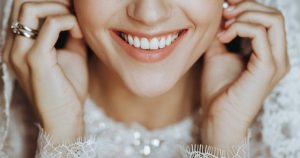 a bride is smiling with bright teeth, representing the important of teeth whitening for wedding.