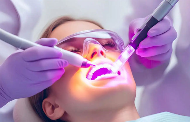 Laser Dentistry