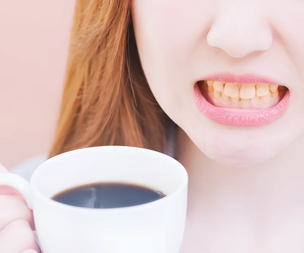 Toronto's coffee culture effect on your teeth: stains