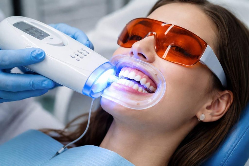 the best teeth whitening options: in-office whitening