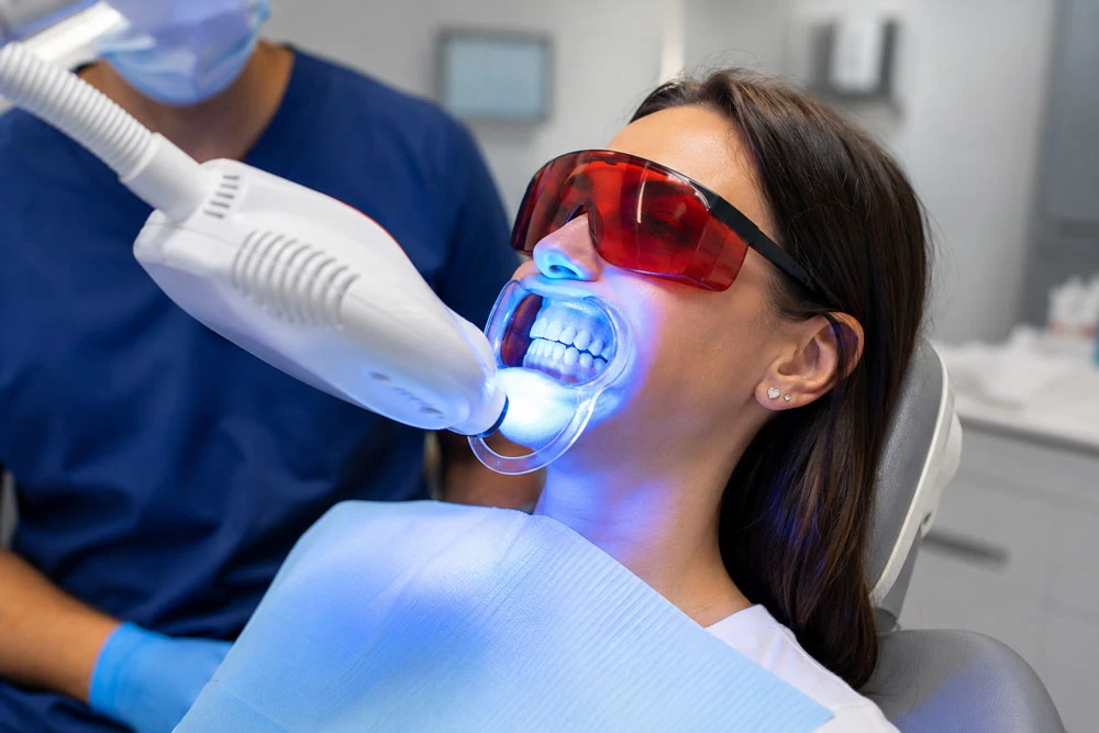 In-Office-Whitening
