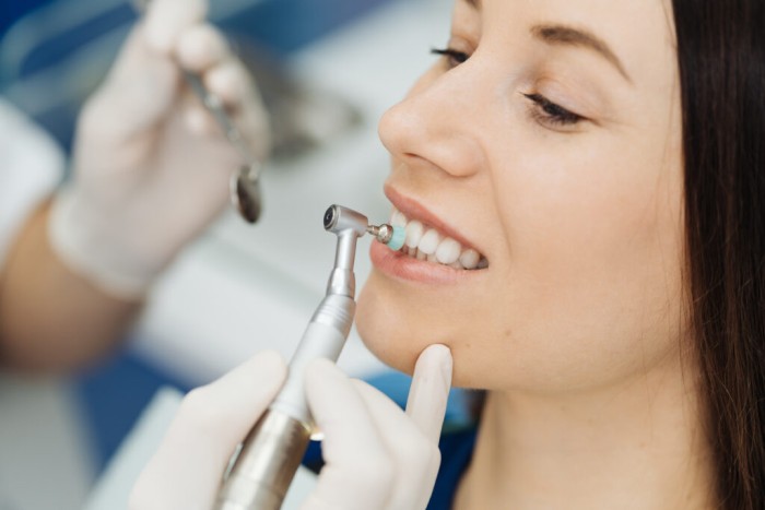 A young woman receiving teeth cleaning and whitening to remove black spots on teeth