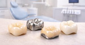 Different types of dental crowns on a table in a dental office